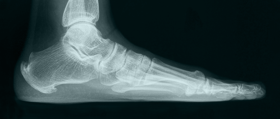 FOOT