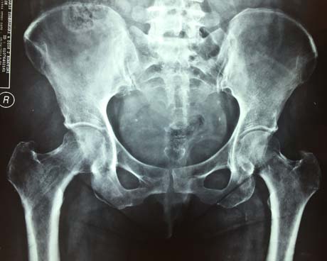 Γεώργιος Δ. Γκουδέλης