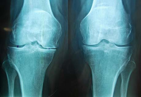 Γεώργιος Δ. Γκουδέλης