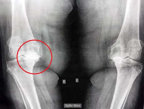 Γεώργιος Δ. Γκουδέλης