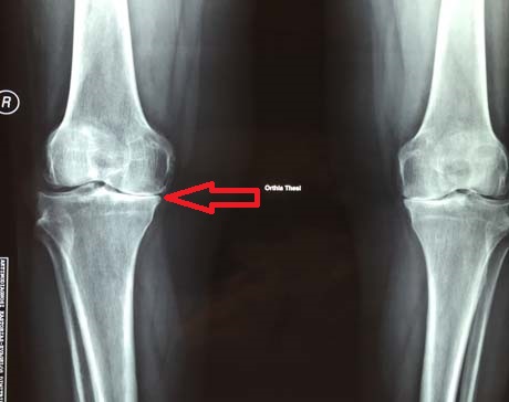 Γεώργιος Δ. Γκουδέλης